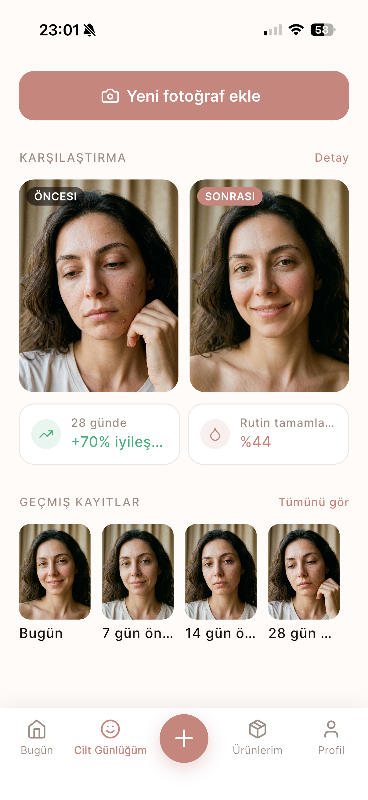 Kuzi — Cilt Günlüğüm ekranı